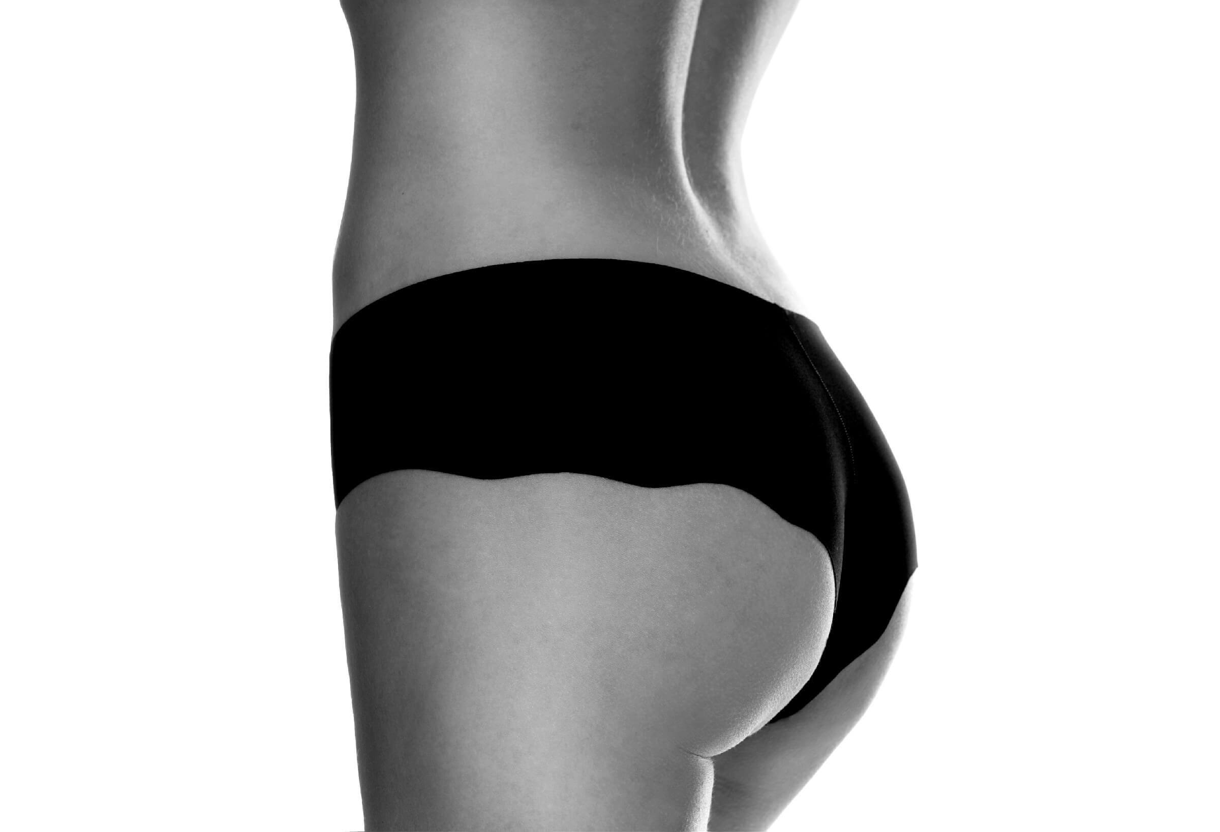 Sculpting Beauty: EmSculpt’s Targeted Treatments for a Toned You EmSculpt effectively targets various areas of the body, including the abdomen, buttocks, and arms. It can help you achieve a firmer, more toned appearance by strengthening and defining your muscles, sculpted like a statue.
